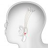 cerebro artificial