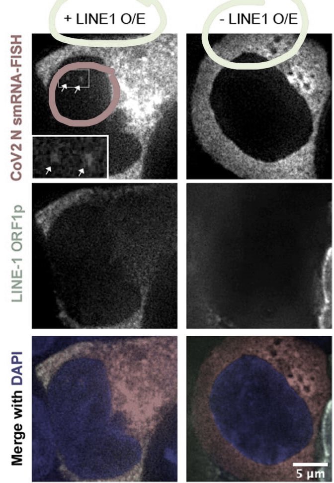 Izquierda: con la expresión de la retrotranscriptasa LINE-1 en la célula el SARS-COV-2 se inserta en el núcleo celular. Derecha: sin retrotranscriptasa en la célula no hay insersion en el genoma