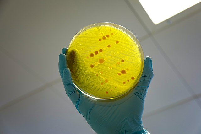 Cultivo microbiano en placa de Petri (Fuente:By DFID – UK Department for International Development – A variety of different bacteria – testing for antimicrobial resistance, CC BY 2.0, https://commons.wikimedia.org/w/index.php?curid=96027057).